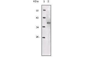 Western blot analysis using IGF1R-Beta mouse mAb against truncated IGF1R recombinant protein. (IGF1R-beta (AA 1101-1367) antibody)