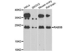 Western blot analysis of extracts of various cell lines, using RAB5B antibody. (RAB5B antibody)