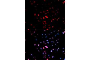 Immunofluorescence analysis of U2OS cell using Phospho-c-Jun-Ser73 antibody. (C-JUN antibody  (pSer73))
