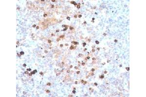 Immunohistochemistry (IHC) image for Mouse anti-Human IgM Heavy Chain antibody (ABIN3026664)