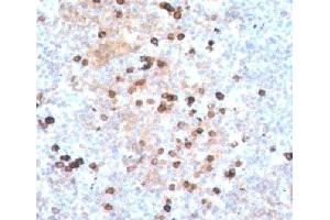 IHC testing of human tonsil stained with IgM heavy chain antibody. (Mouse anti-Human IgM Heavy Chain Antibody)