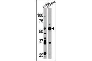 Western blot analysis of anti-G4D Pab 1811a in mouse liver and colon tissue lysate. (ATG4D antibody  (N-Term))