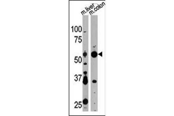 ATG4D antibody  (N-Term)