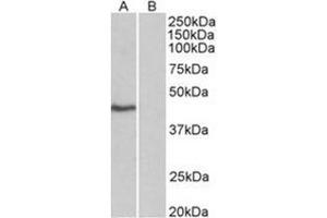 TBP antibody Cat. (TBP antibody  (Isoform 1, N-Term))