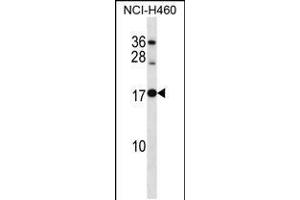 Western blot analysis in NCI-H460 cell line lysates (35ug/lane). (RPL12 antibody  (AA 71-100))