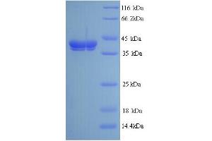 SDS-PAGE (SDS) image for PLY1 (AA 22-367) protein (His tag) (ABIN5713972) (PLY1 (AA 22-367) protein (His tag))