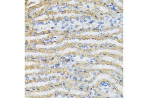 Immunohistochemistry of paraffin-embedded mouse kidney using C4BPB antibody (ABIN5973770) at dilution of 1/100 (40x lens).
