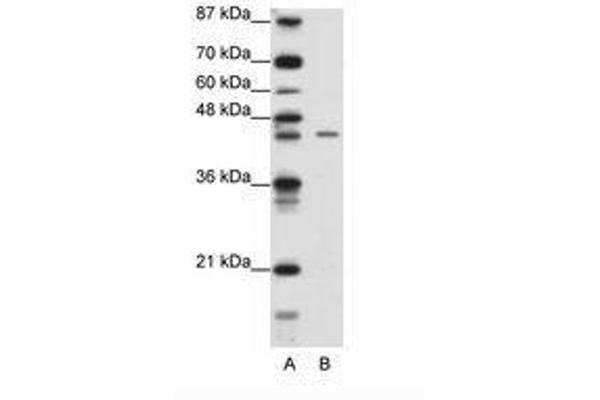 ZNF17 antibody  (N-Term)