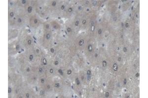 Detection of PTPRF in Human Liver Tissue using Polyclonal Antibody to Protein Tyrosine Phosphatase Receptor Type F (PTPRF) (PTPRF antibody  (AA 30-224))