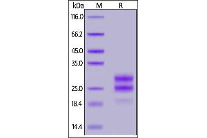 SDS-PAGE (SDS) image for Interleukin 17F (IL17F) (AA 29-161) protein (His tag) (ABIN7013430)