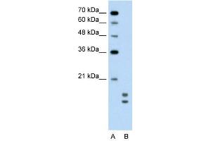 UBE2L3 antibody used at 0.