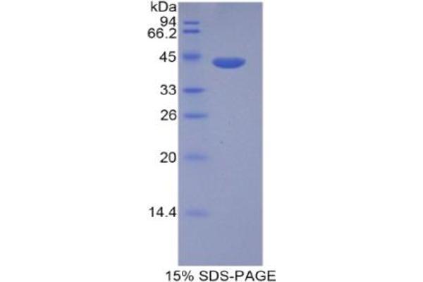 HIST1H2AD Protein