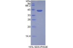 SDS-PAGE analysis of Human HIST1H2AD Protein. (HIST1H2AD Protein)