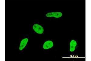 Immunofluorescence of monoclonal antibody to GMNN on HeLa cell. (Geminin antibody  (AA 110-209))