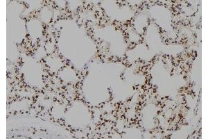 ABIN6277432 at 1/100 staining Rat lung tissue by IHC-P. (SIP1 antibody  (N-Term))