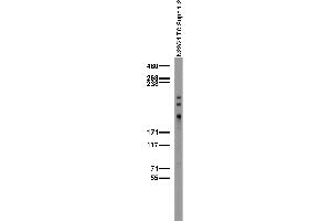 Adult rat brain membrane immunoblot.
