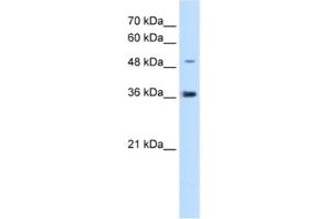 Western Blotting (WB) image for anti-Iroquois Homeobox Protein 1 (IRX1) antibody (ABIN2463089) (IRX1 antibody)