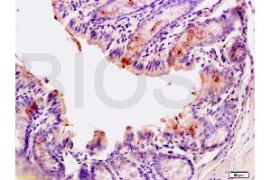 Formalin-fixed and paraffin embedded mouse small intestine tissue labeled with Anti-CD10 Polyclonal Antibody (ABIN669666), Unconjugated at 1:200, followed by conjugation to the secondary antibody and DAB staining (MME antibody  (AA 501-600))