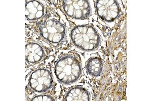 anti-Neurogenin 3 (NEUROG3) (AA 1-83) antibody