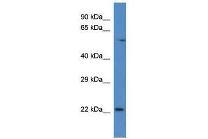 Western Blot showing Rab10 antibody used at a concentration of 1. (RAB10 antibody  (C-Term))
