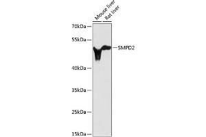 Western blot analysis of extracts of various cell lines, using SMPD2 antibody (ABIN3021604, ABIN3021605, ABIN3021606 and ABIN6215351) at 1:3000 dilution. (SMPD2 antibody  (AA 150-250))