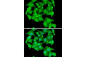 Immunofluorescence analysis of A549 cell using PRKD3 antibody.