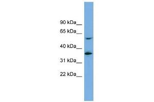 SLC7A7 antibody used at 1 ug/ml to detect target protein.