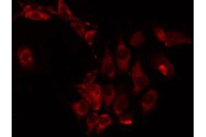 ABIN6274975 staining HepG2 by IF/ICC. (CPT1B antibody  (Internal Region))