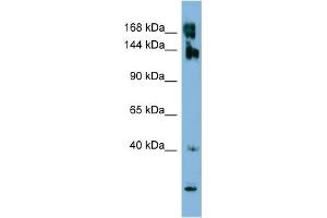 WB Suggested Anti-WNK3 Antibody Titration:  0. (WNK3 antibody  (N-Term))