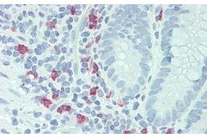 Detection of IL23R in Human Small Intestine Tissue using Polyclonal Antibody to Interleukin 23 Receptor (IL23R) (IL23R antibody  (AA 25-355))