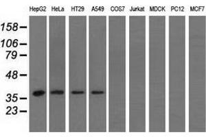 Western blot analysis of extracts (35 µg) from 9 different cell lines by using anti-HIBCH monoclonal antibody. (HIBCH antibody)