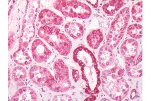 Human Kidney: Formalin Fixed, Paraffin Embedded (FFPE) (DECR1 antibody  (AA 1-335))