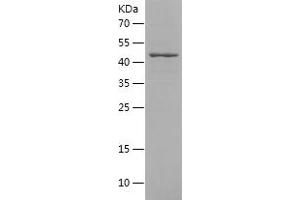 Western Blotting (WB) image for Acyl-CoA Synthetase Medium-Chain Family Member 5 (ACSM5) (AA 80-315) protein (His-IF2DI Tag) (ABIN7287639) (ACSM5 Protein (AA 80-315) (His-IF2DI Tag))