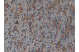 IHC-P analysis of Rat Stomach Tissue, with DAB staining. (ATG7 antibody  (AA 249-517))