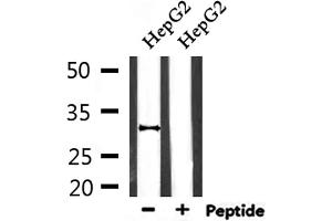 Western blot analysis of extracts from HepG2, using HO-1 Antibody. (HMOX1 antibody  (Internal Region))