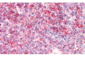 Detection of GBA in Human Spleen Tissue using Polyclonal Antibody to Glucocerebrosidase (GBA) (GBA antibody  (AA 334-498))