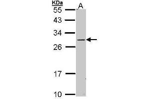 WB Image Sample (30 ug of whole cell lysate) A: Molt-4 , 12% SDS PAGE antibody diluted at 1:1000 (STAR antibody)