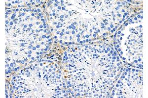 ABIN6263878 and ABIN6272761 at 1/100 staining Mouse testis tissue by IHC-P.