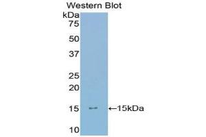 Western Blotting (WB) image for anti-Ly1 Antibody Reactive (LYAR) (AA 288-379) antibody (ABIN1859731) (LYAR antibody  (AA 288-379))