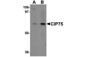 Western blot analysis of CIP75 in 3T3 cell lysate with AP30234PU-N CIP75 antibody at (A) 1 and (B) 2 μg/ml.