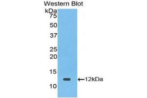 Western blot analysis of the recombinant protein. (TGFA antibody  (AA 42-82))