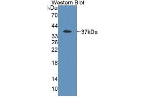 Western blot analysis of the recombinant protein. (PSG2 antibody  (AA 35-335))