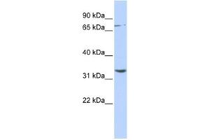 WB Suggested Anti-DPY19L1 Antibody Titration:  0.