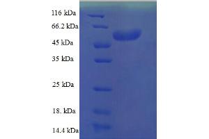 SDS-PAGE (SDS) image for SRY (Sex Determining Region Y)-Box 2 (SOX2) (AA 1-317), (full length) protein (His-SUMO Tag) (ABIN5710406)