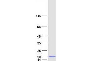 Validation with Western Blot (NR2C2AP Protein (Myc-DYKDDDDK Tag))