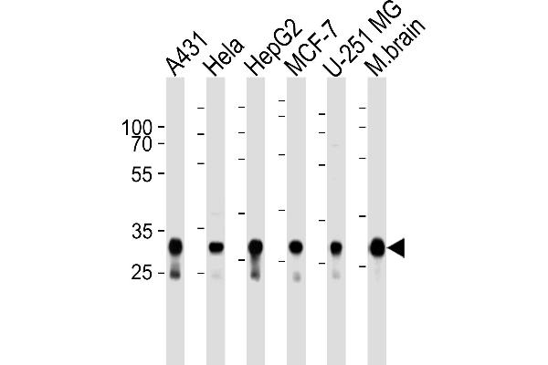 Cytochrome C1 antibody  (AA 142-176)