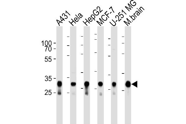 Cytochrome C1 Antikörper  (AA 142-176)