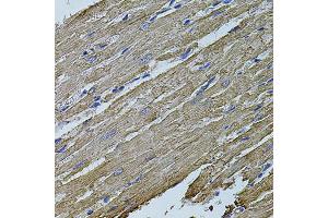 Immunohistochemistry of paraffin-embedded rat heart using MAP1B antibody (ABIN5971696) at dilution of 1/100 (40x lens).