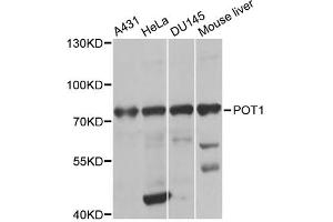 Western blot analysis of extracts of various cell lines, using POT1 antibody (ABIN2650945) at 1:1000 dilution. (POT1 antibody)