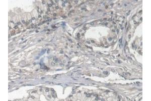 Detection of FBLN1 in Human Prostate Tissue using Monoclonal Antibody to Fibulin 1 (FBLN1) (Fibulin 1 antibody  (AA 176-398))